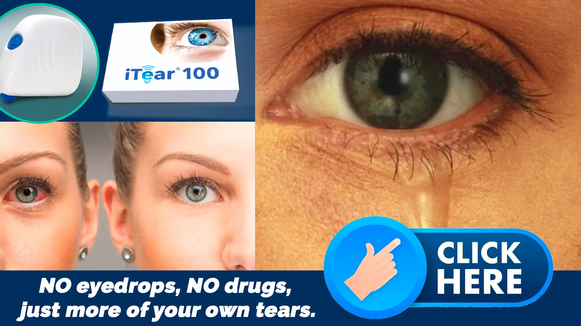 Understanding Tear Production and Dry Eye